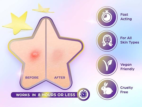 OOTD- Hydrocolloid Star Spot Patch-80 pcs